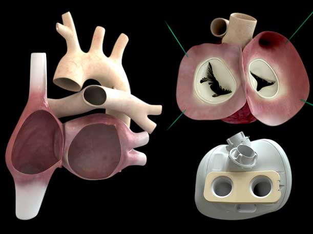 Early designs of total artificial hearts